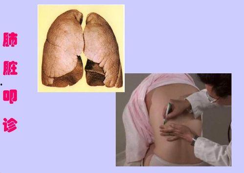 肺上界叩诊视频,肺上界叩诊技巧与案例分析