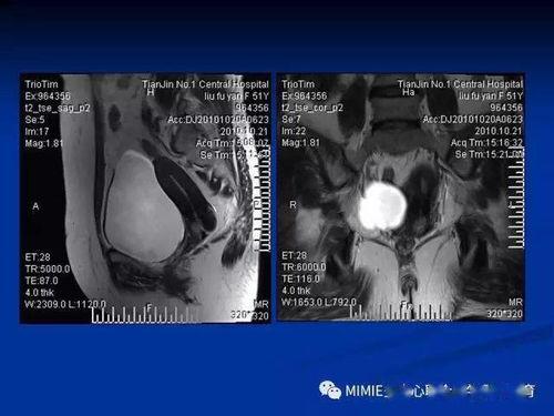德国生殖解剖视频